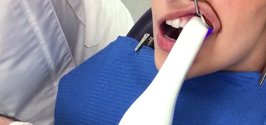 Scanner intra-oral