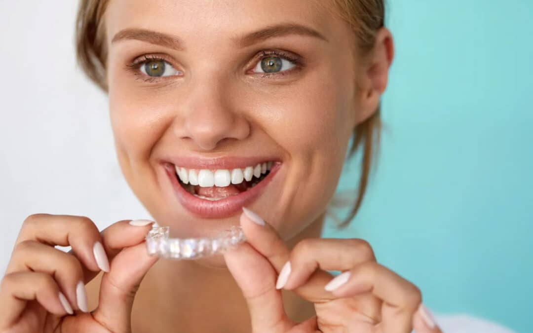 8 Vantagens de optar pelo aparelho dentário invisível