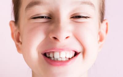 4 Problemas que podem exigir o uso de aparelho dentário